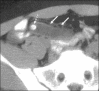 Fig 10