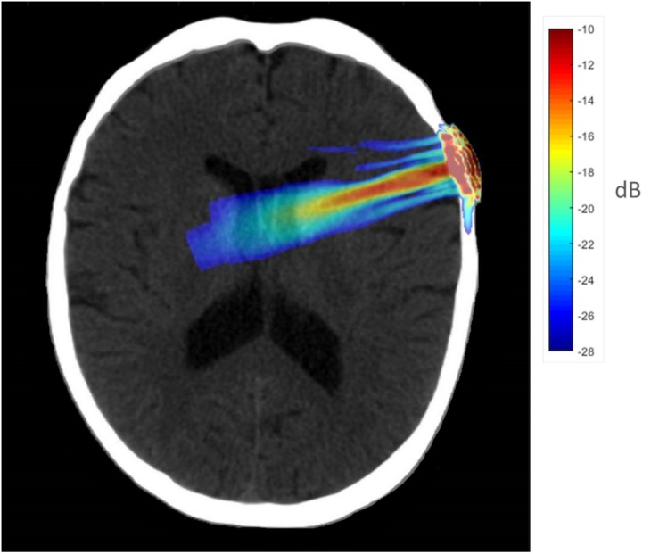 FIGURE 1