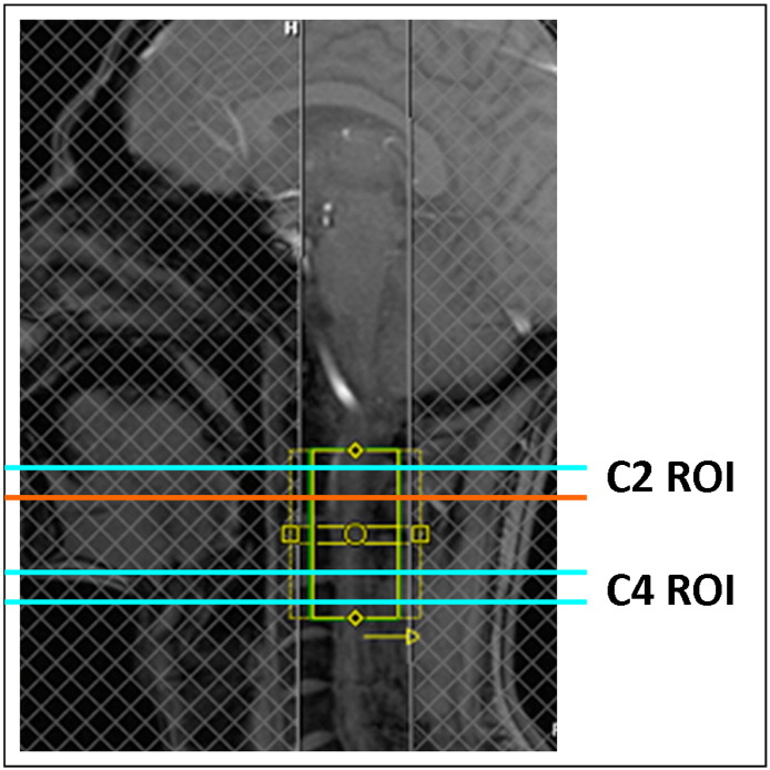 Fig. 1