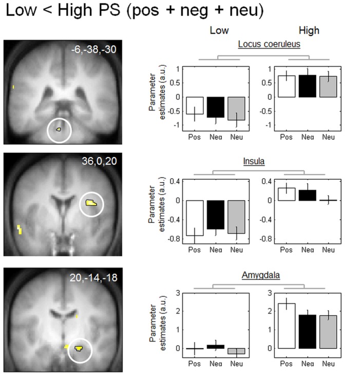 Functional MRI responses to low vs. high PS (regardless of picture valence).