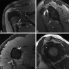 Figure 1(A-D)