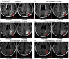Fig. 4