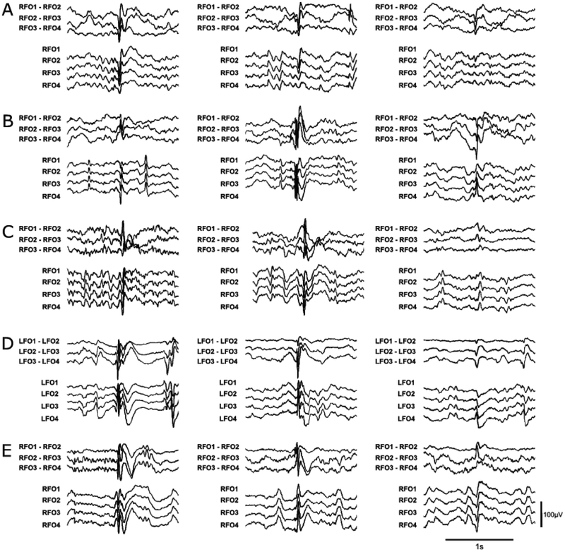 Figure 1: