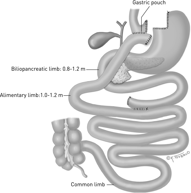 Fig. 1