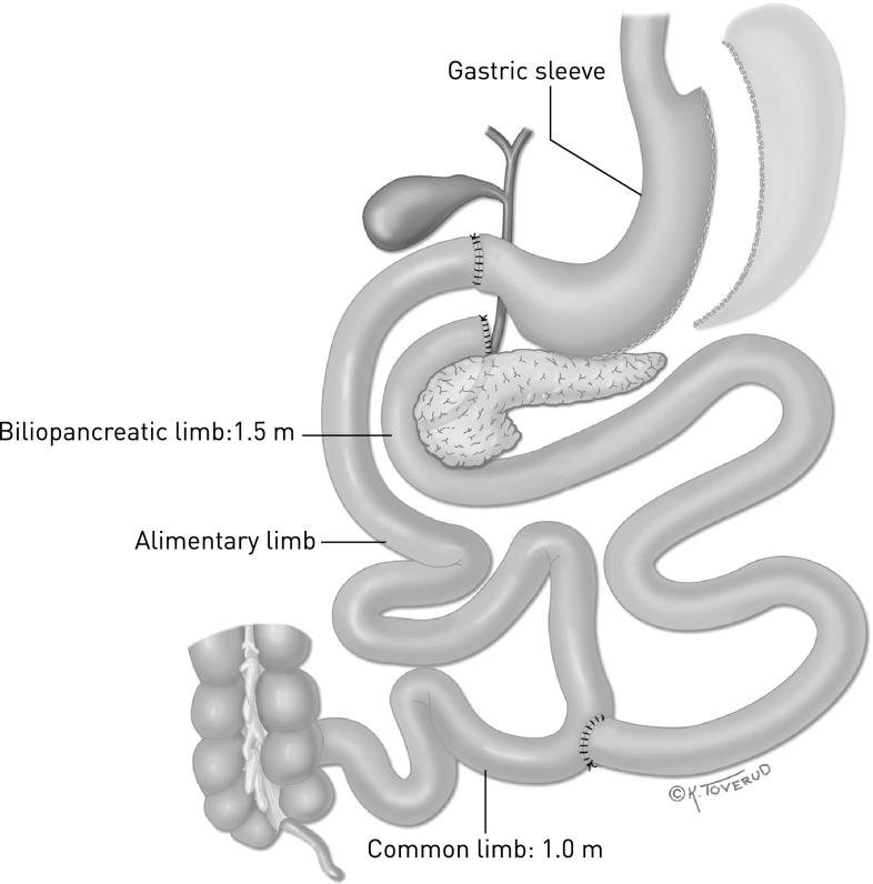 Fig. 2