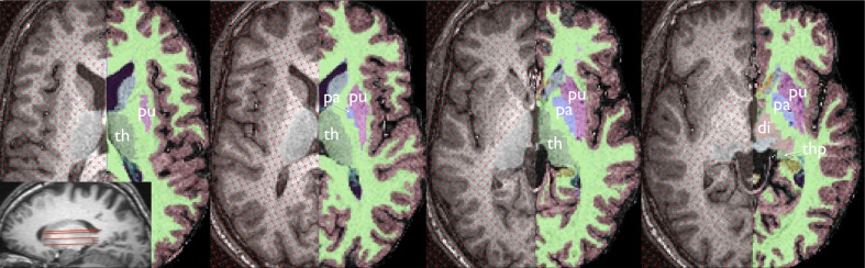 Fig. 1