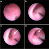 Fig. 1
