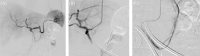 Fig 2 –