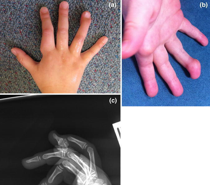 Fig. 2a–c