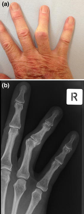 Fig. 12a, b