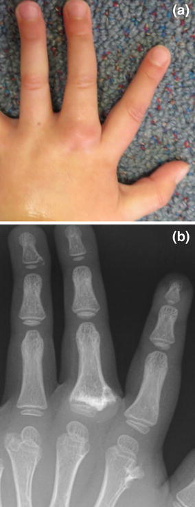 Fig. 3a, b