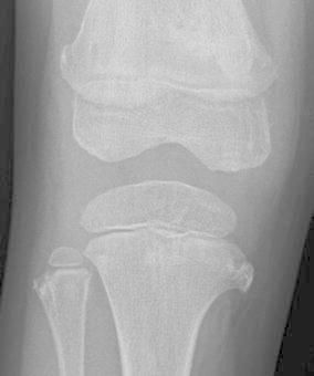 Fig. 8