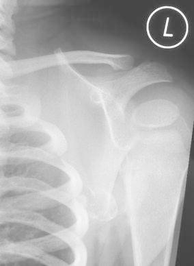 Fig. 9