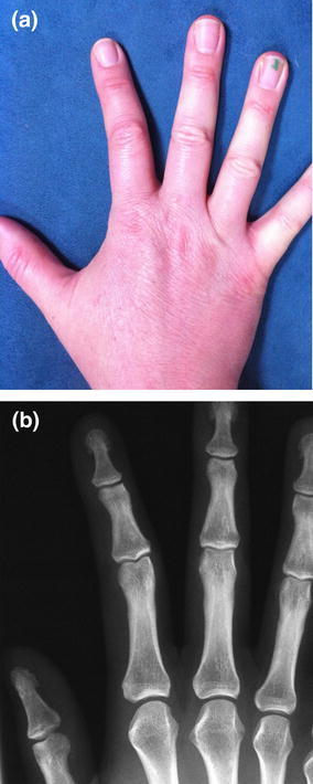 Fig. 11a, b