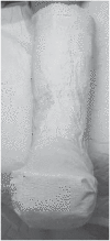 Figure 7c