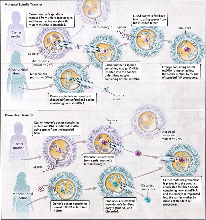 Two Mitochondrial Replacement Techniques — Maternal Spindle Transfer and Pronuclear Transfer