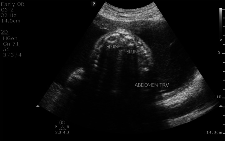 Fig 2