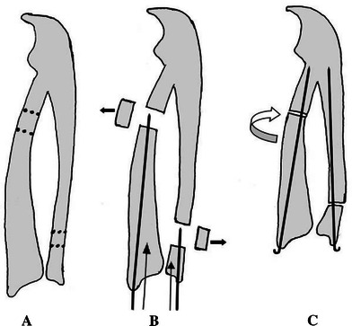 Fig. 3