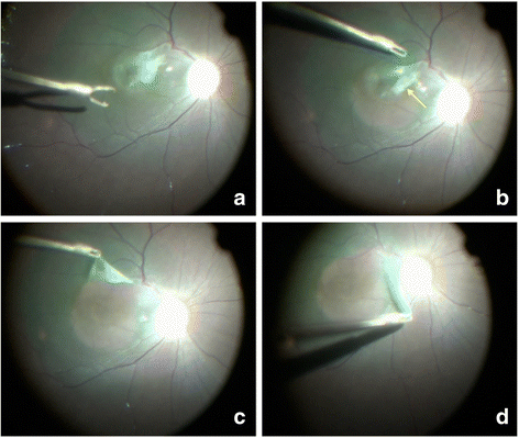 Fig. 3