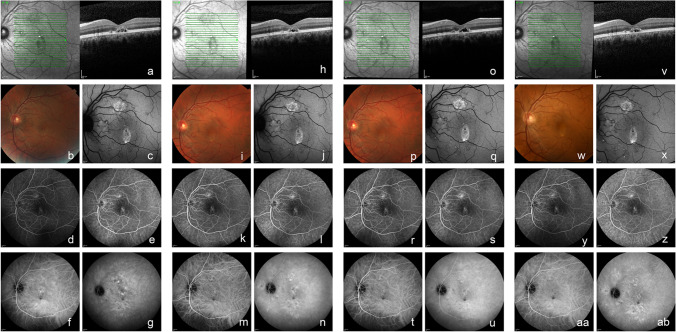 Fig. 3