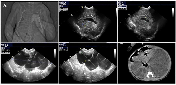 Fig. 2