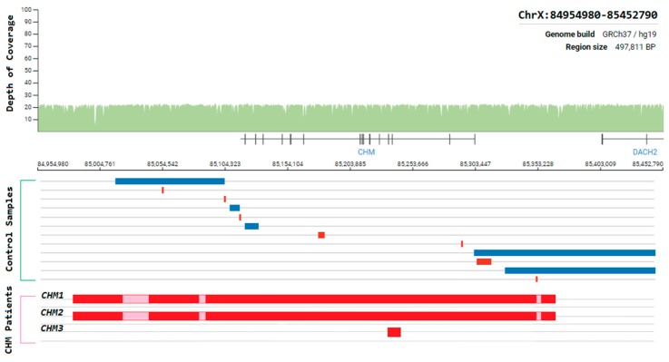 Figure 11