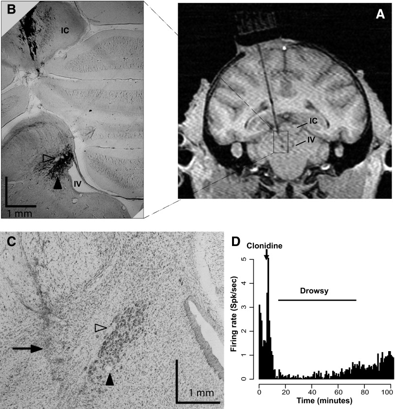 FIG. 2.