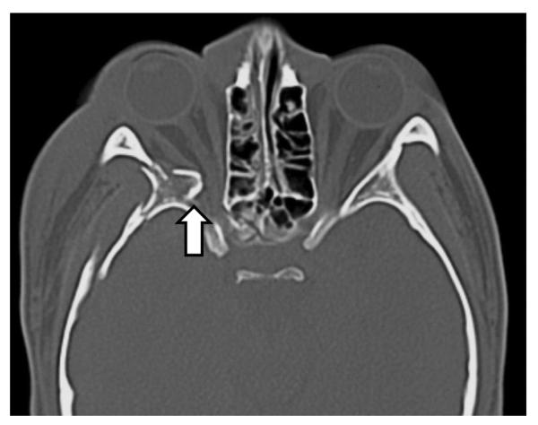 Fig. 5