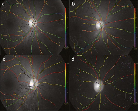 Fig. 1