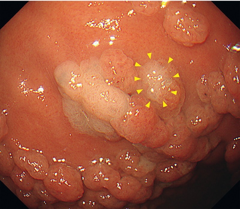 Fig. 1