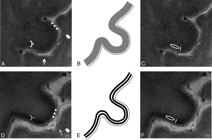 Fig 1.