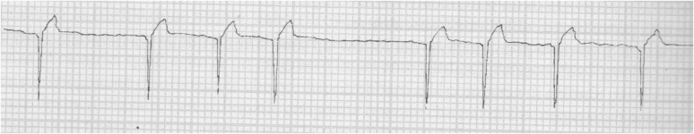 Figure 1: