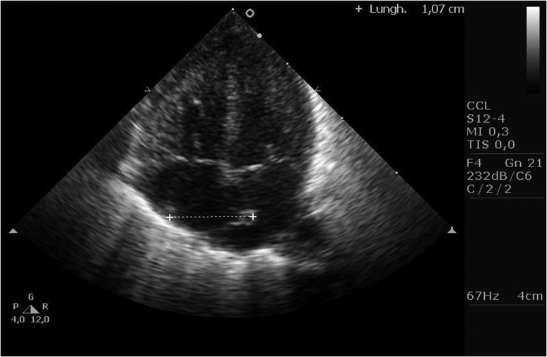 Figure 3: