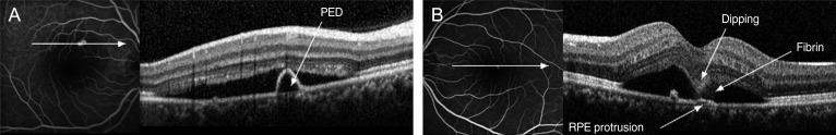 Fig. 4