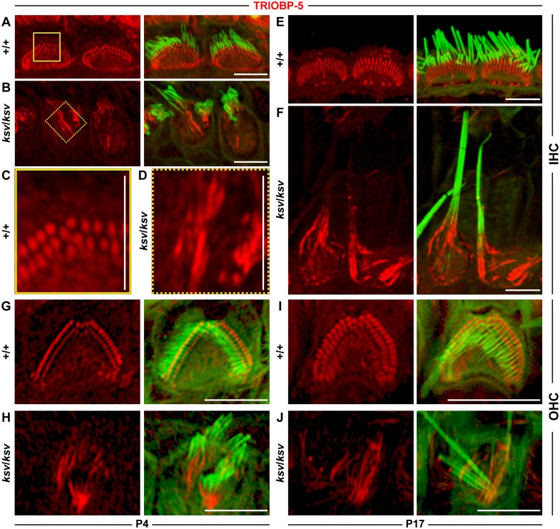 Fig 12