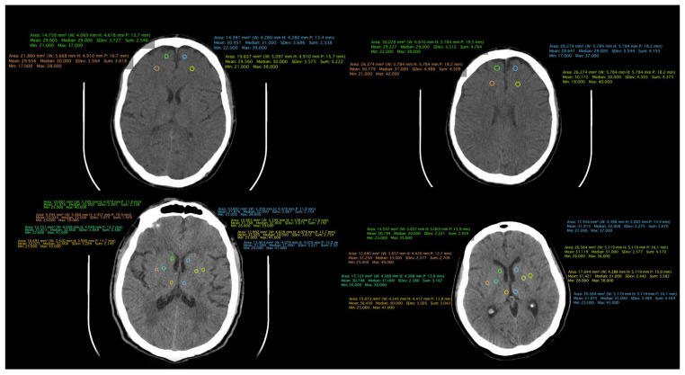 Figure 2