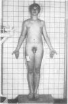 62