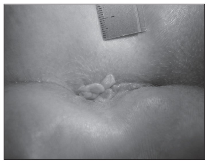 Figure 3a