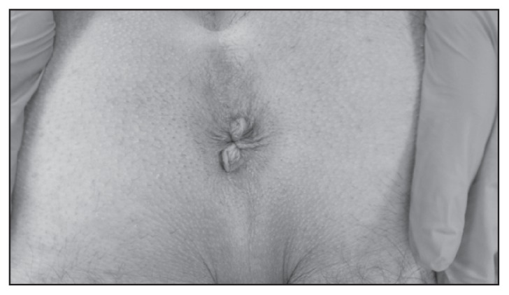 Figure 3b