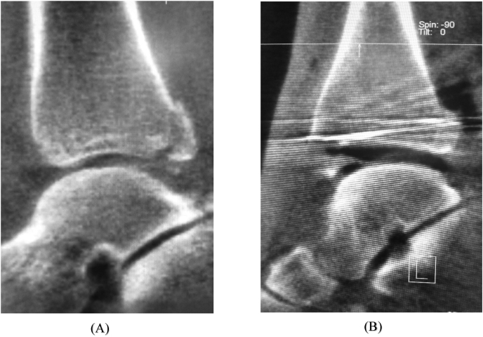 Fig. 8