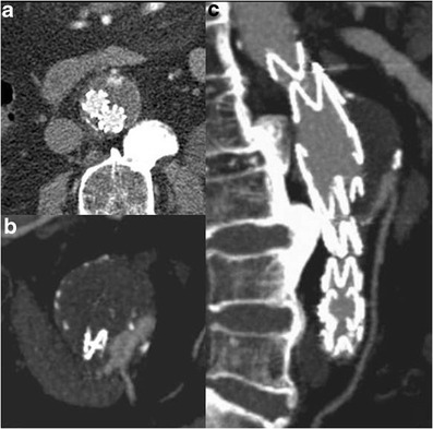 Fig. 11