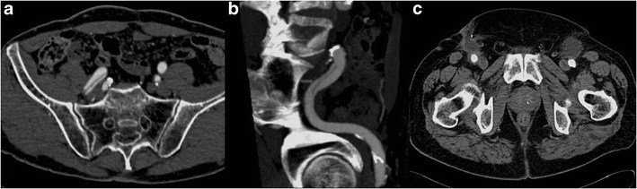 Fig. 15