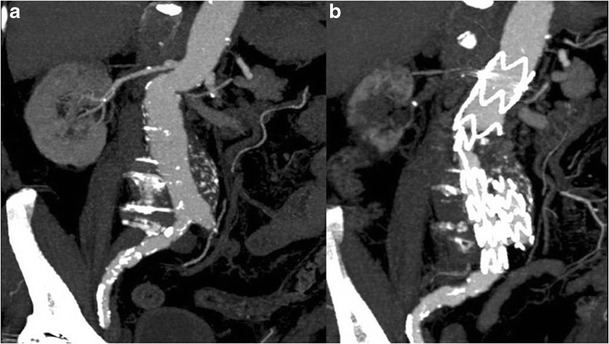 Fig. 14