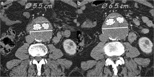 Fig. 13