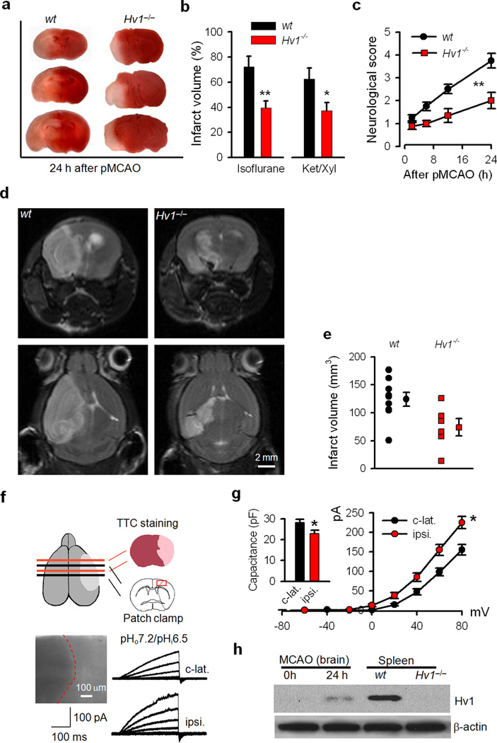 The Voltage–gated Proton Channel, Hv1, Enhances Brain Damage from ...