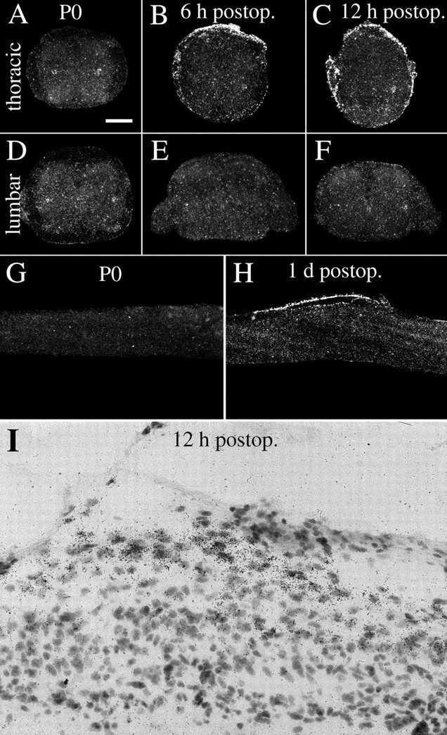 Fig. 12.