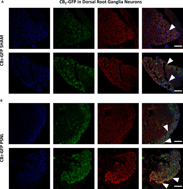 Figure 4—figure supplement 5.