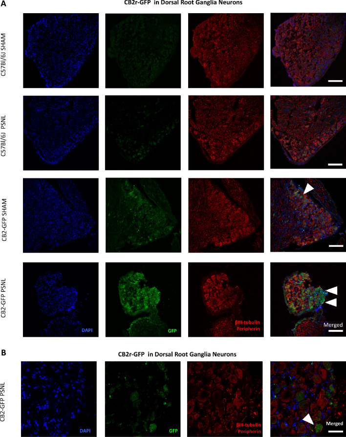 Figure 4—figure supplement 4.