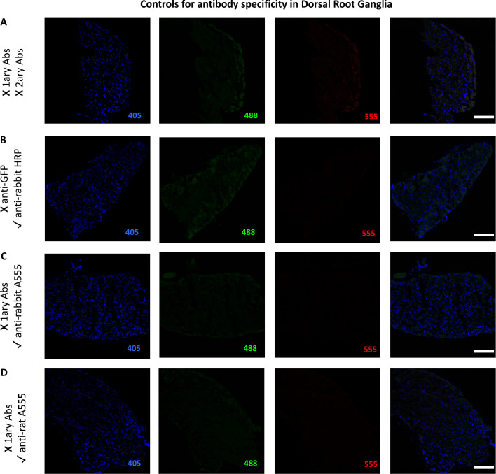 Figure 4—figure supplement 8.