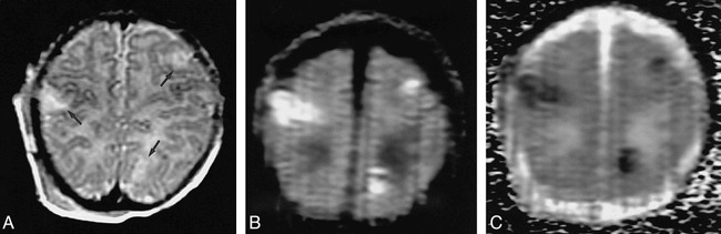 fig 3.